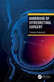 Handbook of Vitreoretinal Surgery - Orginal Pdf